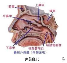 鼻前庭炎